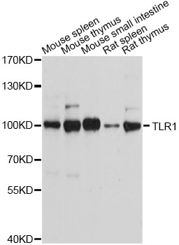 TLR1 Antibody - Western blot analysis of extracts of various cell lines, using TLR1 antibody at 1:1000 dilution. The secondary antibody used was an HRP Goat Anti-Rabbit IgG (H+L) at 1:10000 dilution. Lysates were loaded 25ug per lane and 3% nonfat dry milk in TBST was used for blocking. An ECL Kit was used for detection and the exposure time was 60s.