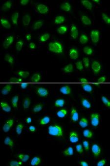 TLR1 Antibody - Immunofluorescence analysis of HeLa cells using TLR1 antibody. Blue: DAPI for nuclear staining.