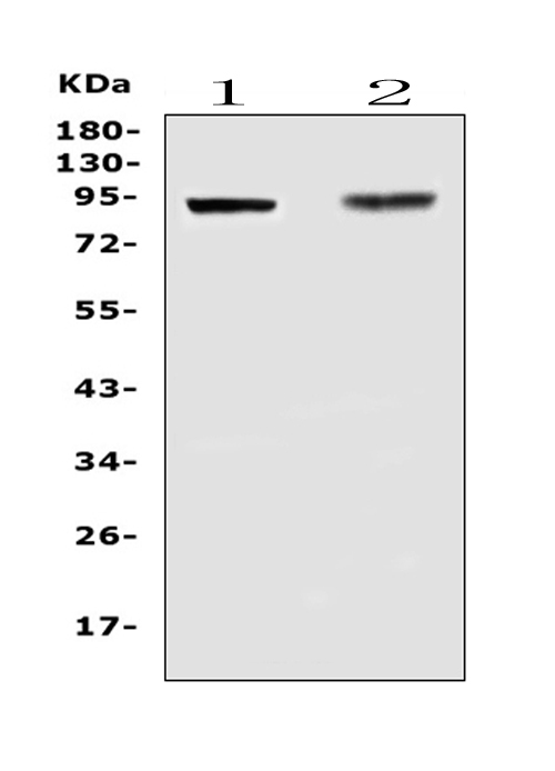 TLR1 Antibody - Western blot analysis of TLR1 using anti-TLR1 antibody. Electrophoresis was performed on a 5-20% SDS-PAGE gel at 70V (Stacking gel) / 90V (Resolving gel) for 2-3 hours. The sample well of each lane was loaded with 50ug of sample under reducing conditions. Lane 1: rat spleen tissue lysates,Lane 2: mouse small intestine tissue lysates. After Electrophoresis, proteins were transferred to a Nitrocellulose membrane at 150mA for 50-90 minutes. Blocked the membrane with 5% Non-fat Milk/ TBS for 1.5 hour at RT. The membrane was incubated with rabbit anti-TLR1 antigen affinity purified polyclonal antibody at 0.5 µg/mL overnight at 4°C, then washed with TBS-0.1% Tween 3 times with 5 minutes each and probed with a goat anti-rabbit IgG-HRP secondary antibody at a dilution of 1:10000 for 1.5 hour at RT. The signal is developed using an Enhanced Chemiluminescent detection (ECL) kit with Tanon 5200 system. A specific band was detected for TLR1 at approximately 90KD. The expected band size for TLR1 is at 90KD.