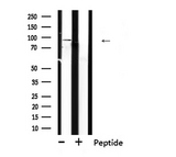 TLR1 Antibody - Western blot analysis of extracts of rat brain lysate using TLR1 antibody.