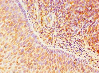 TLR10 Antibody - Immunohistochemistry of paraffin-embedded human tonsil using antibody at 1:100 dilution.