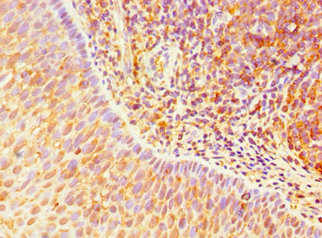 TLR10 Antibody - Immunohistochemistry of paraffin-embedded human tonsil tissue using TLR10 Antibody at dilution of 1:100