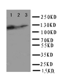 TLR10 Antibody - WB of TLR10 antibody. Lane 1: HELA Cell Lysate. Lane 2: JURKAT Cell Lysate. Lane 3: CEM Cell Lysate.
