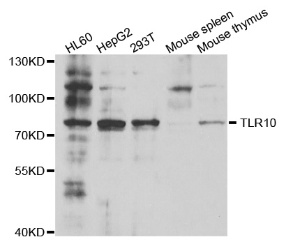 TLR10 Antibody - Western blot analysis of extracts of various cell lines.