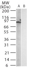 Tlr11 Antibody - Western blot of mouse TLR12 in (A) transfected and (B) untransfected cell lysate using antibody at 1:1000.
