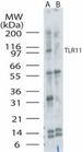 Tlr11 Antibody - Western blot of TLR11 in mouse kidney without (Lane 1) or with (Lane 2) blocking peptide.