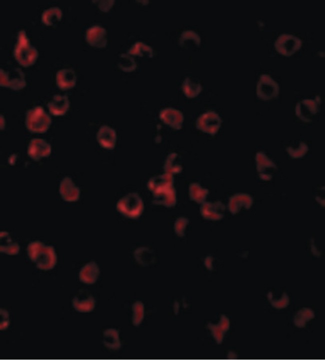 Tlr11 Antibody - Immunofluorescence of TLR11 in Raw264.7 cells with TLR11 antibody at 10 ug/ml.