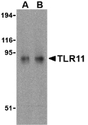 Tlr11 Antibody - Western blot of TLR11 in RAW264.7 cell lysates with TLR11 antibody at (A) 0.5 and (B) 1 ug/ml.