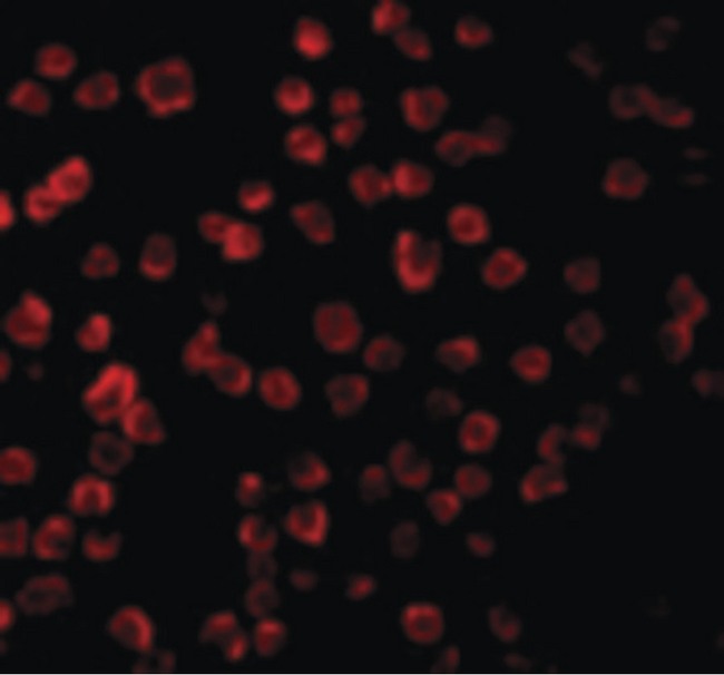Tlr11 Antibody - Immunofluorescence of TLR11 in Raw264 cells with TLR11 antibody at 10 ug/ml.