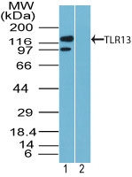 Tlr13 Antibody - Western blot of TLR13 in rat corpus (tissue is from male rat reproductive tract) lysate in the 1) absence and 2) presence of immunizing peptide using Tlr13 Antibody at 1 ug/ml. Goat anti-rabbit Ig HRP secondary antibody, and PicoTect ECL substrate solution, were used for this test.