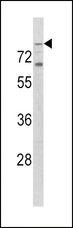 TLR2 Antibody - Western blot of hTLR2-C226 in K562 cell line lysates (35 ug/lane). TLR2 (arrow) was detected using the purified antibody.