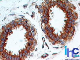 TLR2 Antibody - Immunohistochemistry-Paraffin: TLR2 Antibody (67N17F8) - Formalin-fixed, paraffin-embedded human breast stained with TLR2 antibody at 5 ug/ml.  This image was taken for the unconjugated form of this product. Other forms have not been tested.