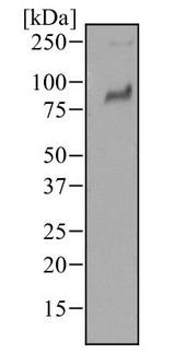 TLR2 Antibody - Western Blot: TLR2 Antibody (67N8F8) - Western blot analysis of human lymph node tissue using TLR2 antibody at a concentration of 1 ug/ml.  This image was taken for the unconjugated form of this product. Other forms have not been tested.