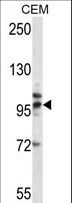TLR2 Antibody - TLR2 Antibody western blot of CEM cell line lysates (35 ug/lane). The TLR2 antibody detected the TLR2 protein (arrow).