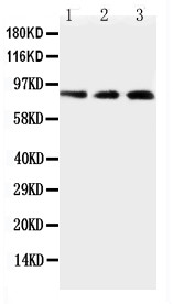 TLR2 Antibody - WB of TLR2 antibody. Lane 1: U937 Cell Lysate. Lane 2: HELA Cell Lysate. Lane 3: JURKAT Cell Lysate.