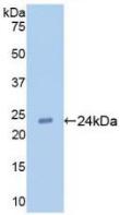 TLR2 Antibody - Western Blot; Sample: Recombinant TLR2, Human.