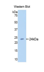 TLR2 Antibody - Western blot of recombinant TLR2.  This image was taken for the unconjugated form of this product. Other forms have not been tested.