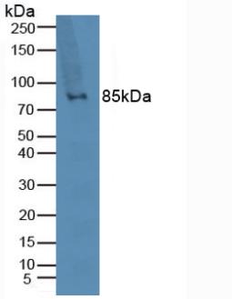 TLR2 Antibody - Western Blot; Sample: Human Lymphocytes Cells.