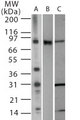 TLR2 Antibody - Western blot of TLR2 in (A) 15 ugs of Raw cell lysate (B) mouse TLR2 transfected cell lysate and (C) Ramos cell lysate using antibody at 1 ug/ml.