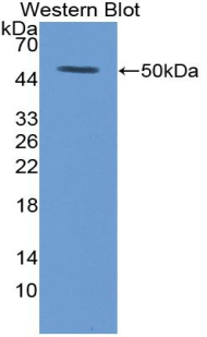 TLR2 Antibody - Western blot of recombinant TLR2.  This image was taken for the unconjugated form of this product. Other forms have not been tested.