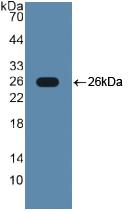 TLR2 Antibody - Western Blot; Sample: Recombinant TLR2, Human.