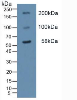 TLR2 Antibody - Western Blot; Sample: Mouse Liver Tissue.