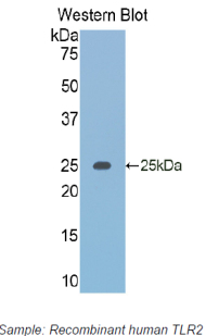 TLR2 Antibody - Western blot of recombinant TLR2.  This image was taken for the unconjugated form of this product. Other forms have not been tested.