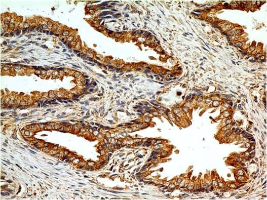 TLR2 Antibody - Fig-2: Immunohistochemical analysis of TLR2 in human prostate tissue using TLR2 antibody at 5 µg/ml.