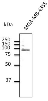 TLR2 Antibody - Western blot. Anti-TLR2 antibody at 1:500 dilution. Rabbit polyclonal to goat IgG (HRP) at 1:10000 dilution.