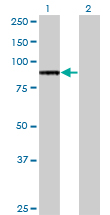 TLR2 Antibody - Western blot of TLR2 expression in transfected 293T cell line by TLR2 monoclonal antibody (M38), clone 2G9.