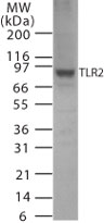 TLR2 Antibody - Western blot of mTLR2 in 15 ul/lane of transfected cell lysate using antibody at 1 ug/ml.