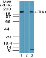TLR3 Antibody - Western blot of TLR3 in Daudi cell lysate in the 1) absence and 2) presence of immunizing peptide and 3) 3T3 cell lysate using Peptide-affinity Purified Polyclonal Antibody to TLR3/CD283 at 2 ug/ml. Goat anti-rabbit Ig HRP secondary antibody, and PicoTect ECL substrate solution, were used for this test.