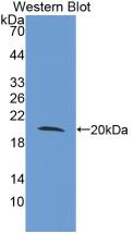 TLR3 Antibody - Western Blot;Sample: Recombinant TLR3, Human