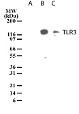 TLR3 Antibody - Western blot of TLR3 in lysates from untransfected 293 cells (lane A), 293 cells transfected with human TLR3 cDNA (lane B), and 20 ug/lane human intestine tissue lysate (lane C).