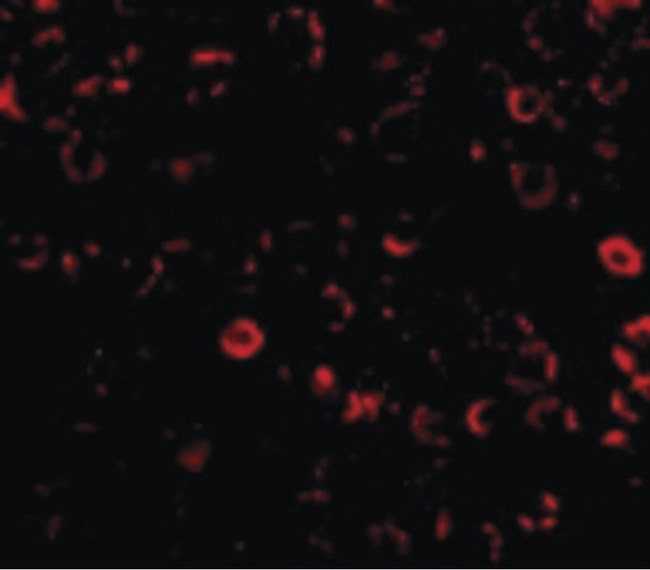 TLR3 Antibody - Immunofluorescence of TLR3 in El4 cells with TLR3 antibody at 10 ug/ml.