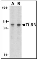 TLR3 Antibody - Western blot of TLR3 in Daudi cell lysate with TLR3 antibody at (A) 1 and (B) 2 ug/ml.