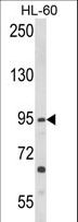 TLR3 Antibody - Western blot of TLR3 Antibody in HL-60 cell line lysates (35 ug/lane). TLR3 (arrow) was detected using the purified antibody.