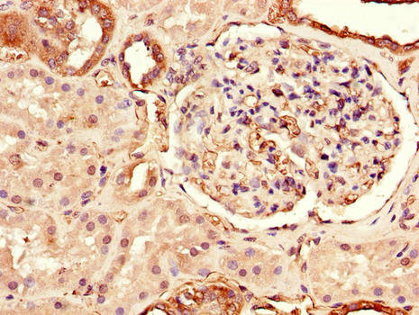 TLR3 Antibody - Immunohistochemistry of paraffin-embedded human kidney tissue using TLR3 Antibody at dilution of 1:100