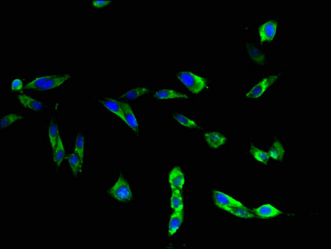 TLR3 Antibody - Immunofluorescent analysis of Hela cells using TLR3 Antibody at a dilution of 1:100 and Alexa Fluor 488-congugated AffiniPure Goat Anti-Rabbit IgG(H+L)