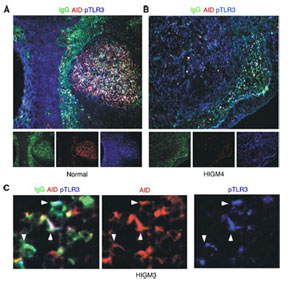 TLR3 Antibody - Immunofluorescence of IgG, AID and TLR3 (Polyclonal Antibody to TLR3 (Phospho Tyr759)) expression in a healthy donor (A) and a hyper-IgM (HIGM) syndrome patient (B and C). A and B: Paraformaldehyde-fixed, frozen tonsillar mucosa tissue sections. C. Paraformaldehyde-fixed, mucosal B cells from the colon lamina propria of the HIGM patient. Arrowheads indicate cells co-expressing phospho TLR3, AID, and IgG.