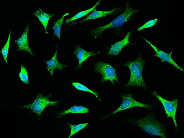 TLR3 Antibody - Immunofluorescence staining of TLR3 in HeLa cells. Cells were fixed with 4% PFA, permeabilzed with 0.1% Triton X-100 in PBS, blocked with 10% serum, and incubated with rabbit anti-Human TLR3 polyclonal antibody (dilution ratio 1:1000) at 4°C overnight. Then cells were stained with the Alexa Fluor 488-conjugated Goat Anti-rabbit IgG secondary antibody (green) and counterstained with DAPI (blue). Positive staining was localized to Cytoplasm.