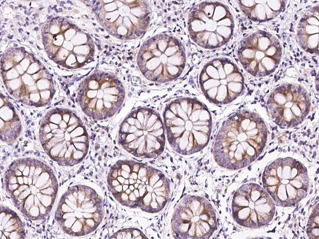 TLR3 Antibody - Immunochemical staining of human TLR3 in human colon with rabbit polyclonal antibody at 1:500 dilution, formalin-fixed paraffin embedded sections.