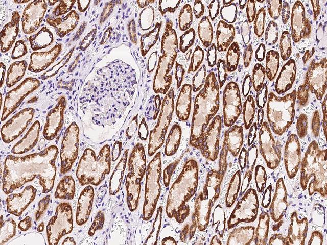 TLR3 Antibody - Immunochemical staining of human TLR3 in human kidney with rabbit polyclonal antibody at 1:500 dilution, formalin-fixed paraffin embedded sections.