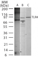 TLR4 Antibody - Western blot of TLR4 using antibody on (A) 0.1 ug/lane recombinant mouse TLR4 protein (tested at 2 ug/ml), (B) 20 ug/lane human intestine, and (C) 20 ug/lane mouse intestine (tested at 5 ug/ml on intestine lysates).
