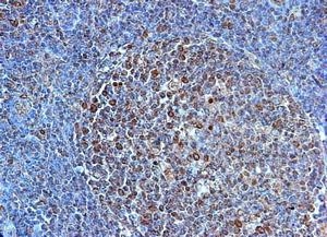TLR4 Antibody - Immunohistochemistry of paraffin-embeddedi human tonsil stained with Goat anti-human CD284