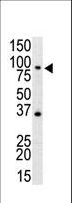 TLR4 Antibody - Western blot of anti-mTLR4 antibody in mouse spleen cell lysate. mTLR4 (arrow) was detected using purified antibody. Secondary HRP-anti-rabbit was used for signal visualization with chemiluminescence.