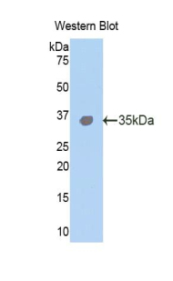 TLR4 Antibody - Western blot of recombinant TLR4.  This image was taken for the unconjugated form of this product. Other forms have not been tested.