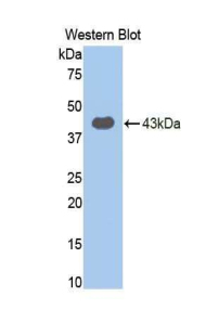 TLR4 Antibody - Western blot of recombinant TLR4.  This image was taken for the unconjugated form of this product. Other forms have not been tested.