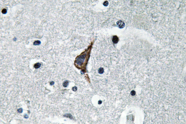 TLR4 Antibody - Immunohistochemistry analysis of TLR4 antibody in paraffin-embedded human brain tissue.