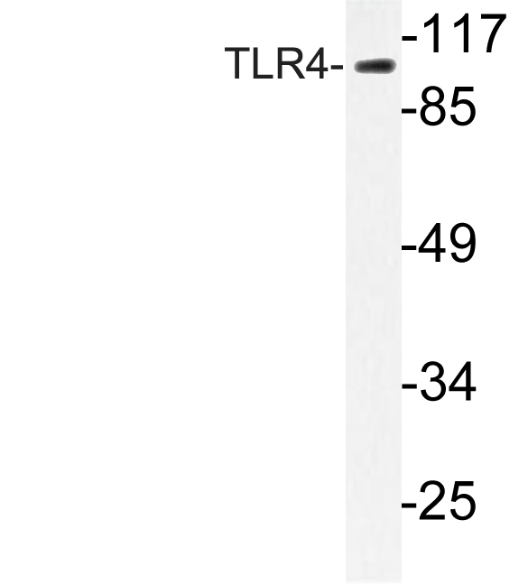 TLR4 Antibody - Western blot analysis of lysate from HeLa cells, using TLR4 antibody.